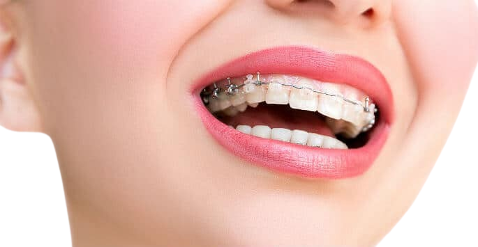 Invisalign and Orthodontic Care