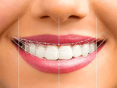 Invisalign and Orthodontic Care